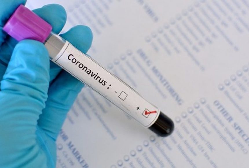 На Дніпропетровщині за добу виявили 988 нових випадків COVID-19 