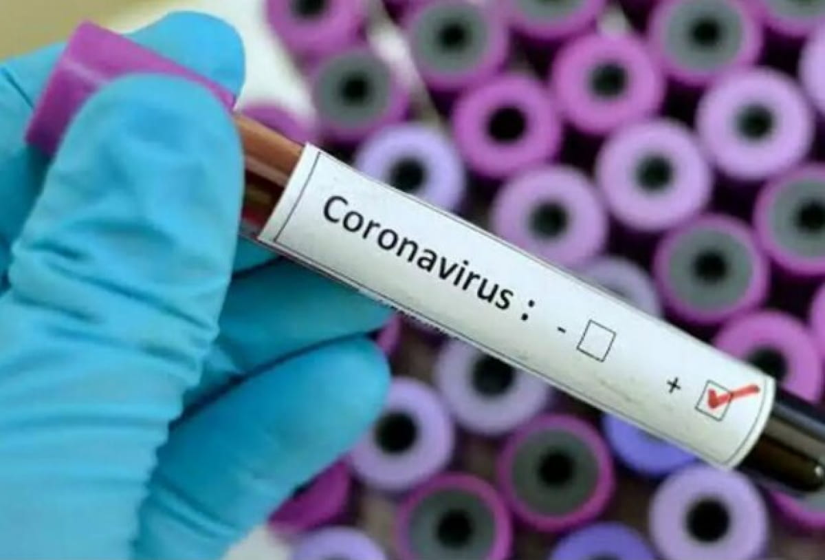 В Днепропетровской области выявили 24 новых случая заболевания коронавирусом