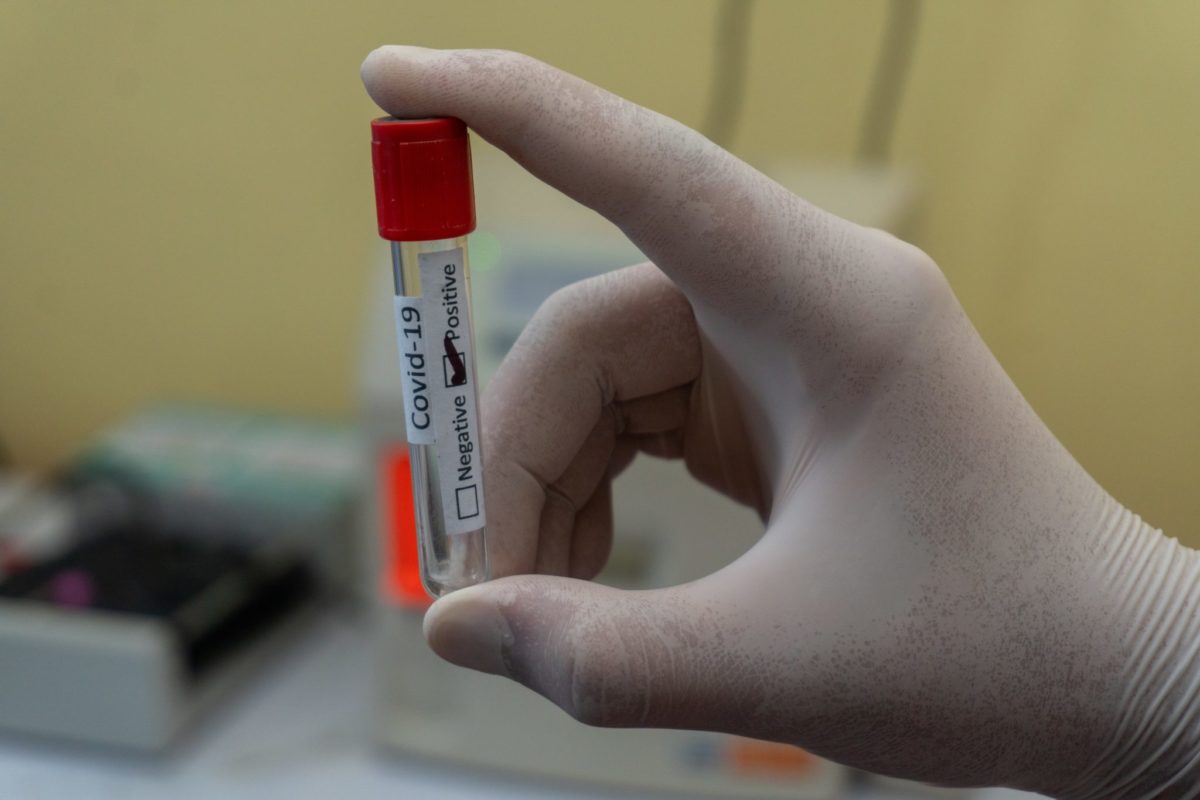 За добу коронавірус виявили у 98 мешканців Дніпропетровщини 