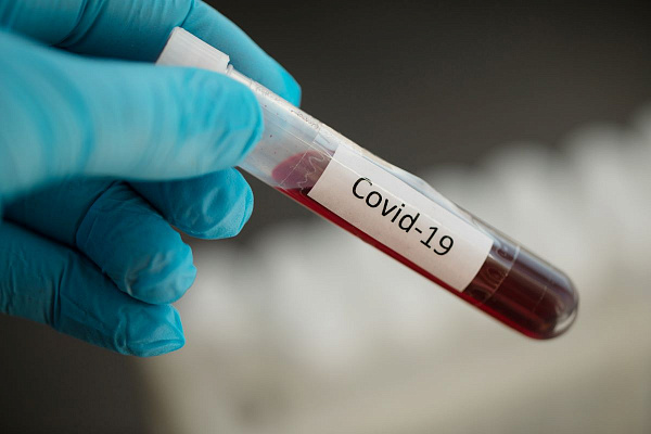 Украина перешла отметку в 5 тыс. заболевших коронавирусом за сутки