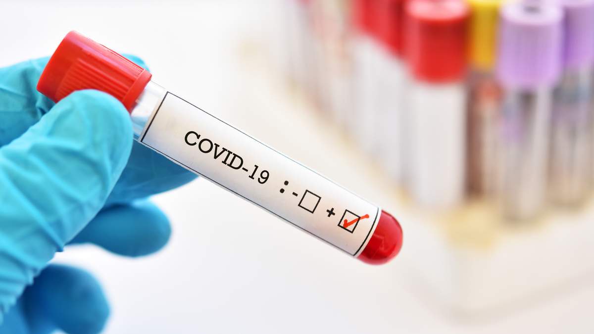 За добу в області зафіксували 2254 нові випадки коронавірусу 