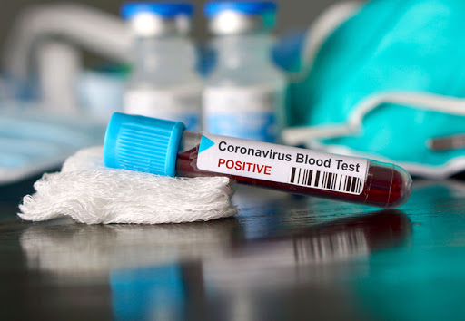 За сутки в Украине 6 506 новых случаев коронавируса