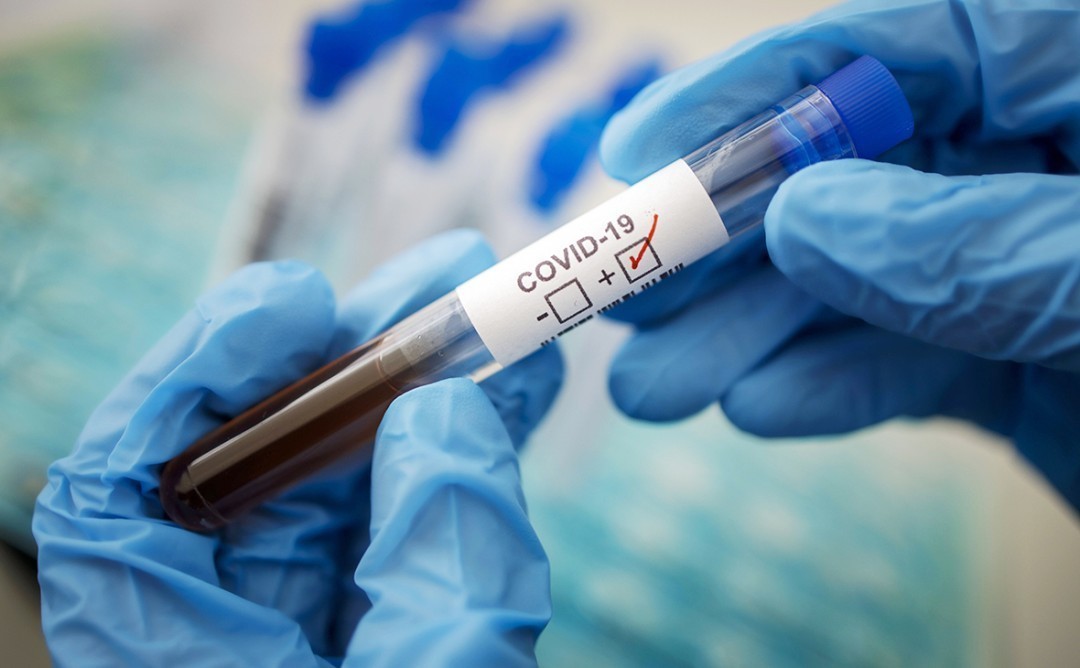В Днепре врачей экстренно переучивают для работы с больными коронавирусом