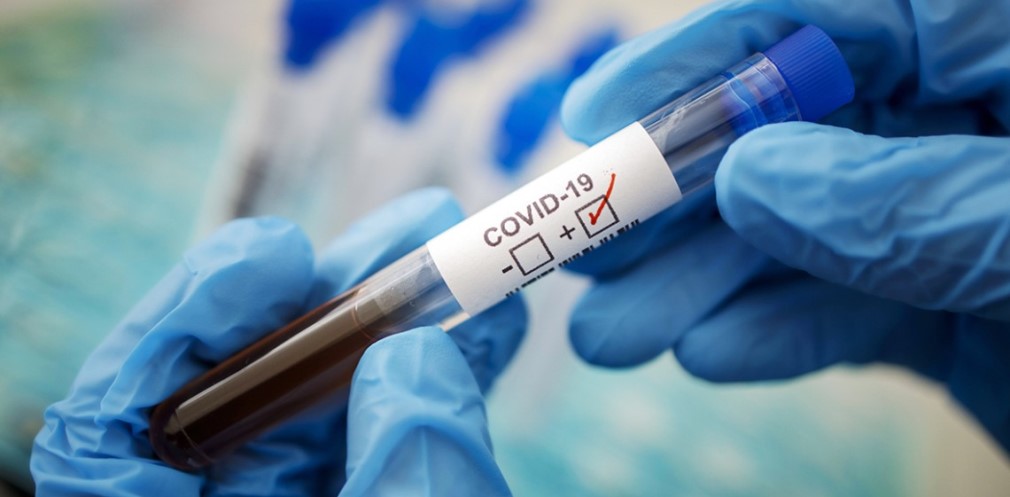 273 випадки коронавірусу виявили на Дніпропетровщині за добу 