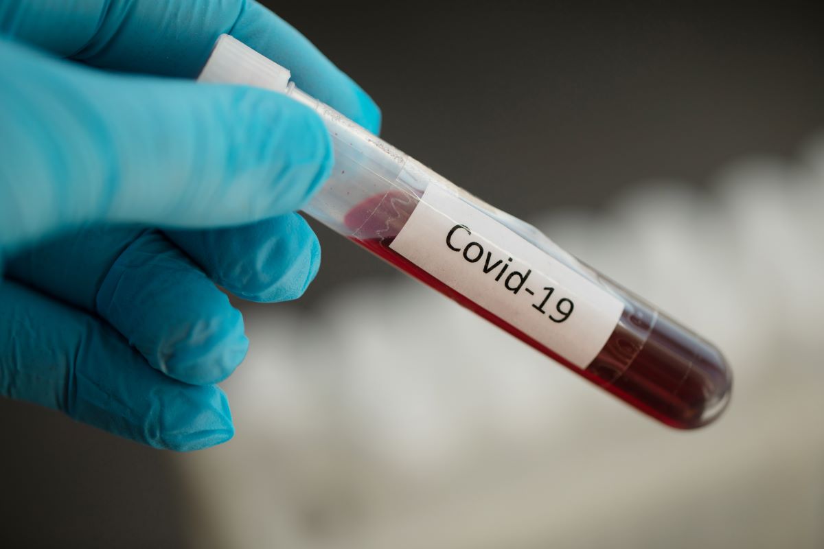 В Украине испытывают четыре препарата для лечения коронавируса