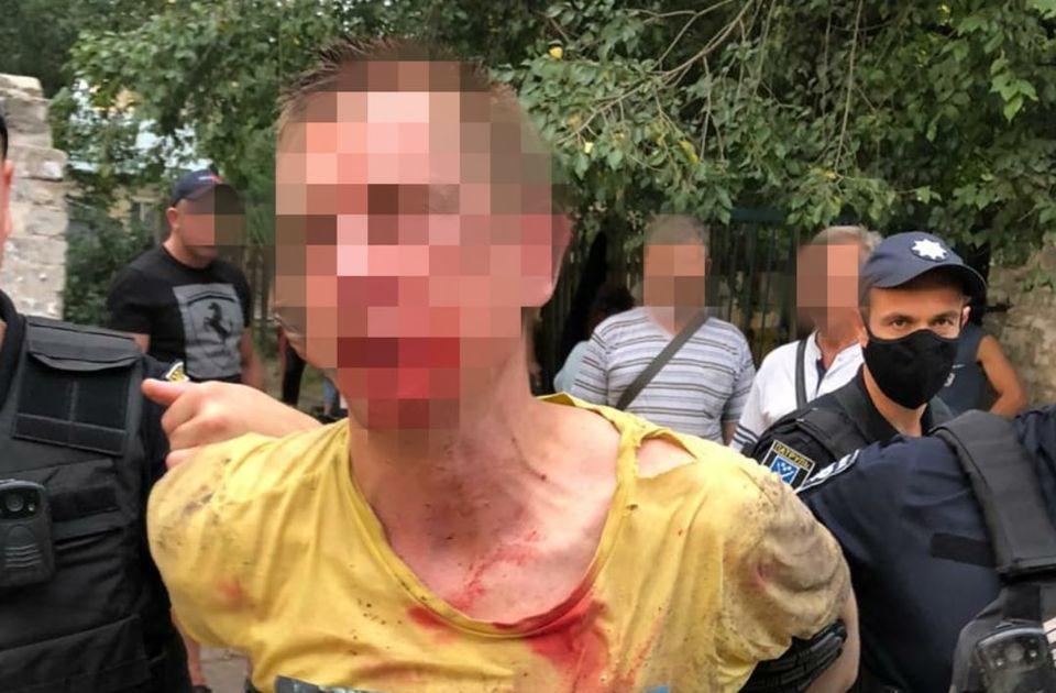 В Днепре мужчина кинул гранату в прохожих: двое пострадавших