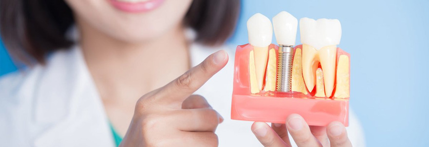 ﻿АТОшники Днепропетровщины могут бесплатно сделать имплантацию зубов