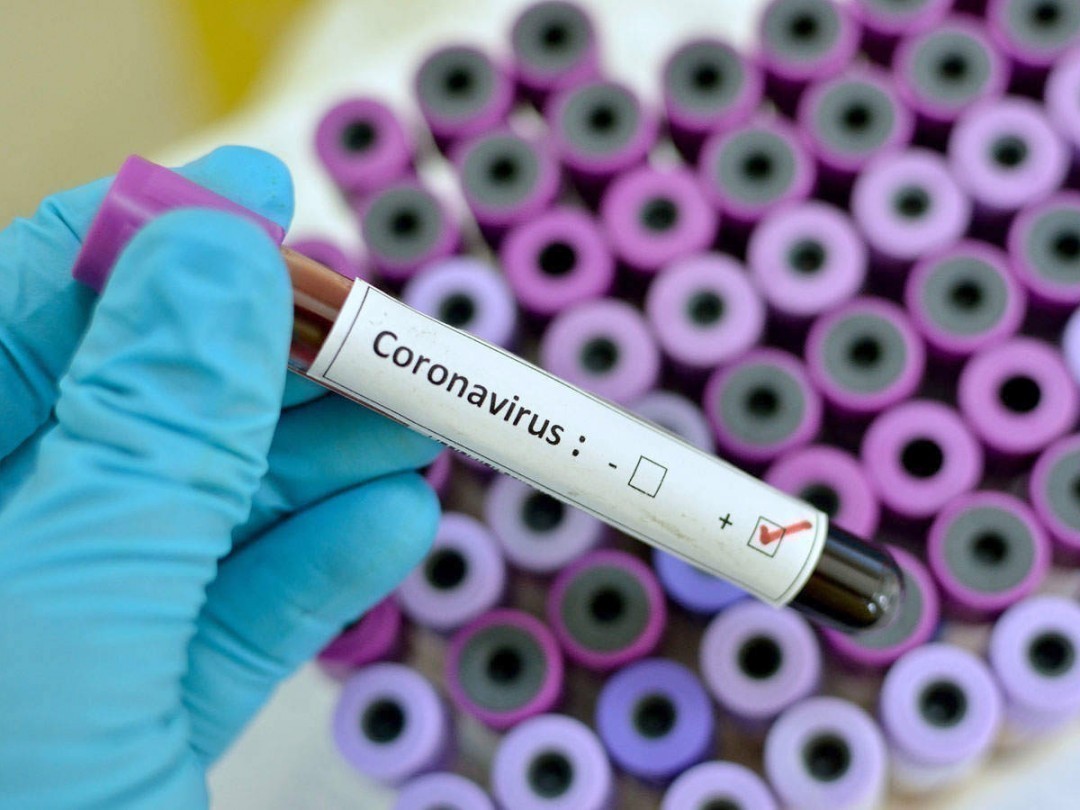 После первого дня вакцинации в Украине обнаружено более 8 тыс. инфицированных коронавирусом
