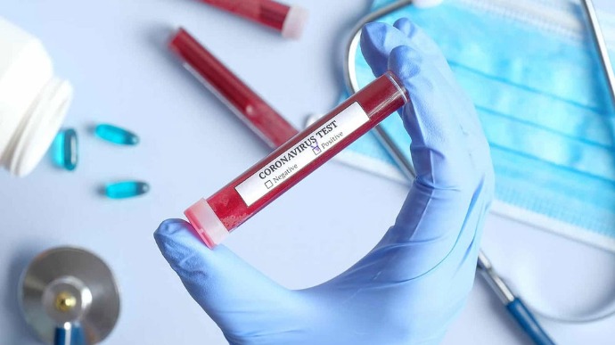На Днепропетровщине выявили 12 новых случаев коронавирусной болезни