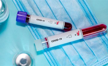 За сутки в Днепропетровской области выявили 25 новых случаев коронавирусной болезни