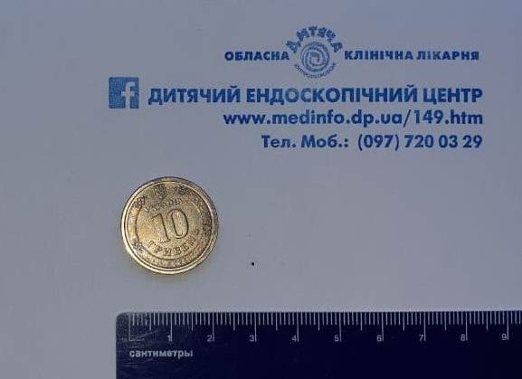 В Днепре ребенок проглотил 10-гривневую монету