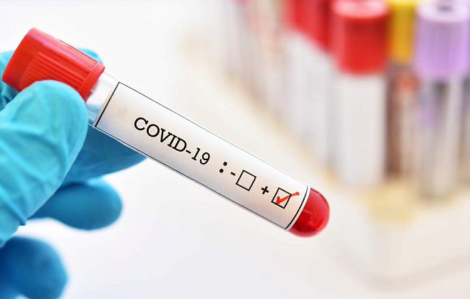 За останню добу в регіоні діагностували 2420 нових випадків COVID-19