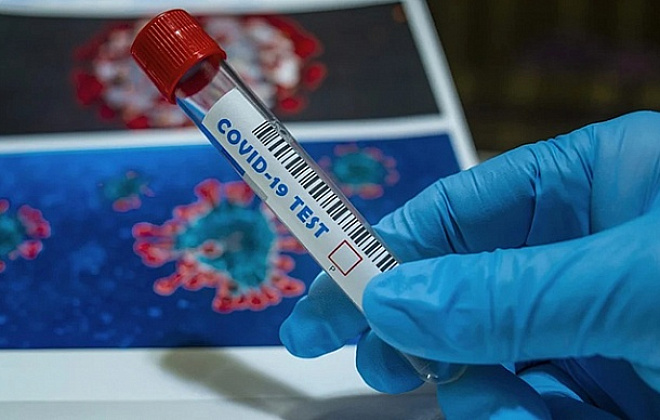 На Дніпропетровщині зафіксували 987 нових випадків коронавірусу