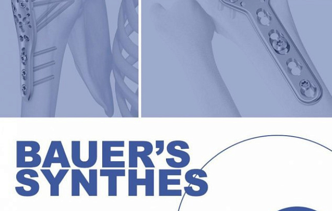 Высокопрочные титановые пластины и дополнительный хирургический набор для операций: обзор продукции для остеосинтеза Bauer`s Synthes