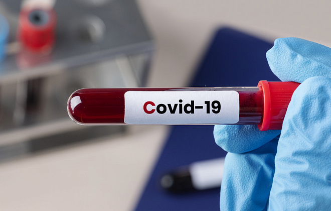 За добу на Дніпропетровщині виявили 237 нових випадків COVID-19 
