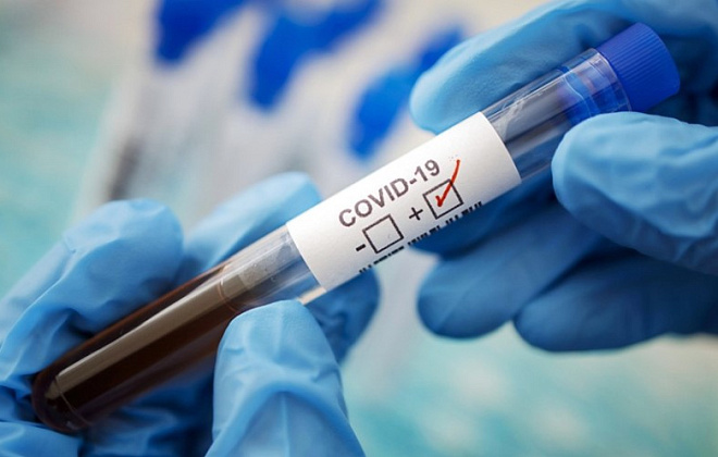 273 випадки коронавірусу виявили на Дніпропетровщині за добу 