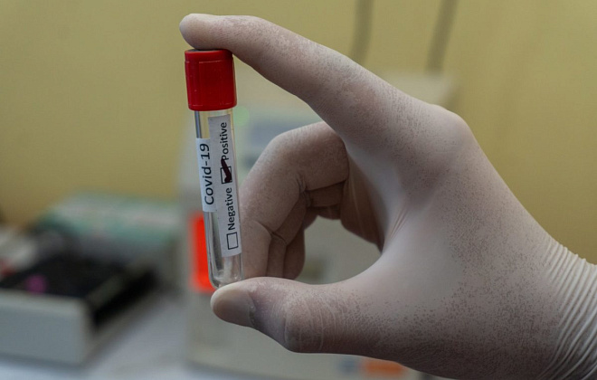 За добу коронавірус виявили у 98 мешканців Дніпропетровщини 