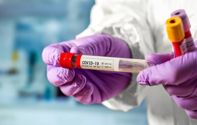 Новых случаев COVID-19 на Днепропетровщине – 31, еще 67 человек – преодолели болезнь 