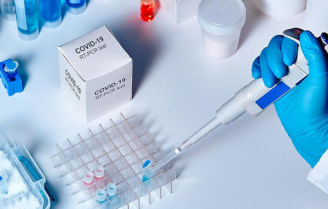 Минздрав Украины внедряет новый вид тестов на коронавирус