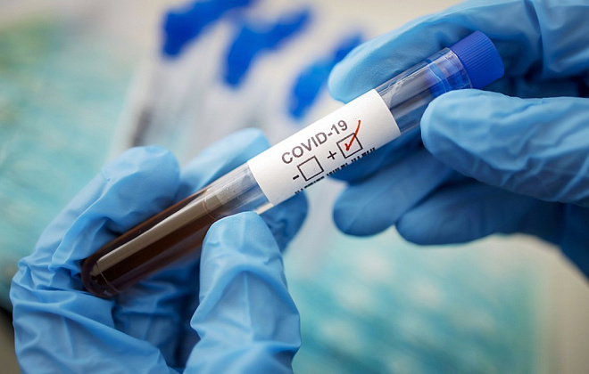В Днепре больница Мечникова запускает дополнительные реанимации для больных коронавирусом