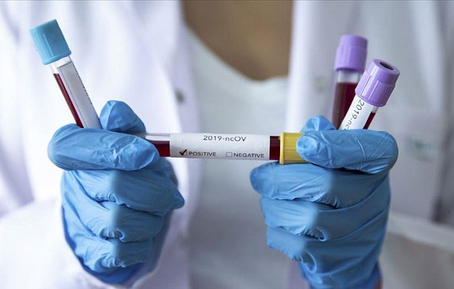 На Дніпропетровщині зафіксували 556 нових випадків коронавірусу