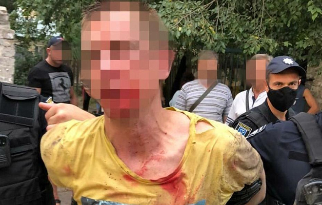 В Днепре мужчина кинул гранату в прохожих: двое пострадавших