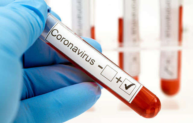 За добу на Дніпропетровщині виявили 781 новий випадок COVID-19