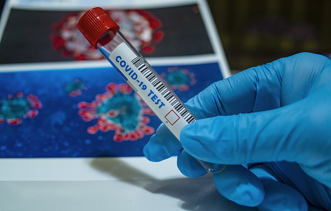 За сутки в области два десятка новых случаев коронавируса, еще 22 человека – выздоровели  