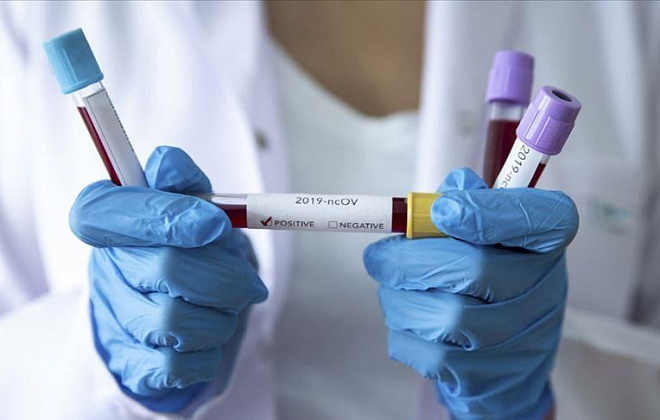 За сутки в Украине выявлено 2,5 тыс. заболевших коронавирусом 