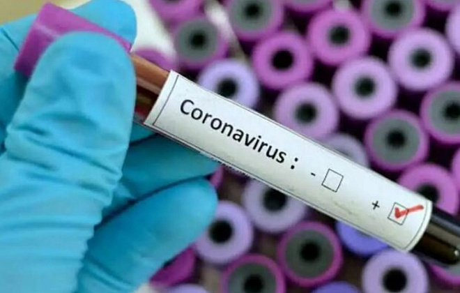 Еще 104 жителя Днепропетровщины заболели коронавирусом, выздоровели - 72
