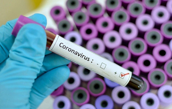 За сутки в Украине +4773 новых случаев коронавируса